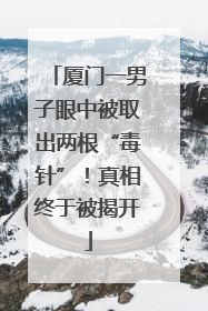 厦门一男子眼中被取出两根“毒针”！真相终于被揭开